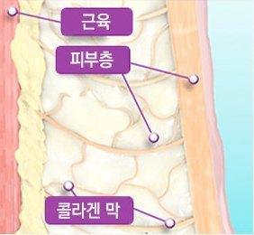 피부 단면 일러스트 — 표피, 지방층, 진피 콜라겐 그물, 근육층. 근육·피부층·콜라겐 막 위치가 표시돼 있다