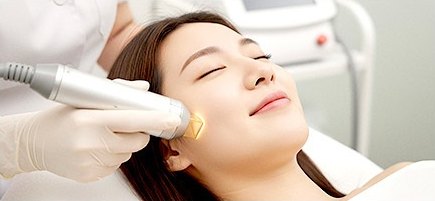 시술 베드에 누운 환자의 얼굴에 레이저 핸드피스를 대고 있는 시술 장면