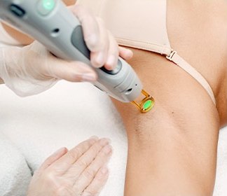 장갑을 낀 시술자가 초록 조사창이 달린 레이저 핸드피스로 겨드랑이 부위 아이스 제모 시술을 진행하는 모습