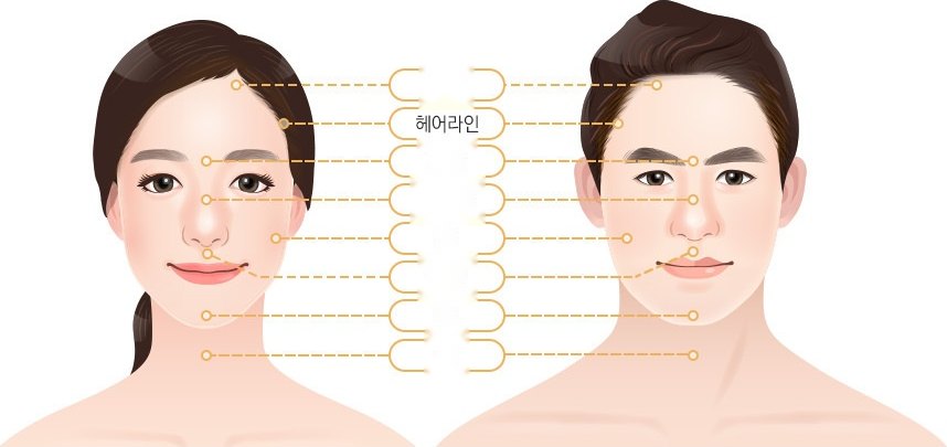 여자얼굴·남자얼굴 제모 부위 안내도