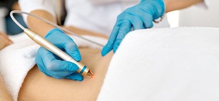 파란 니트릴 장갑을 낀 시술자의 두 손이 금색 레이저 핸드피스로 환자 복부를 시술하는 클로즈업