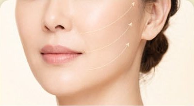 鼻先と唇、頬と顎が見える女性の顔の下半分の正面クローズアップ — ほうれい線まわりと深部頬リフティングの施術部位